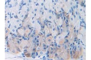 #VALUE! (Leptin antibody  (AA 22-167))