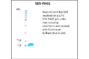 SDS-PAGE (SDS) image for Epidermal Growth Factor (EGF) (Active) protein (ABIN5509414)