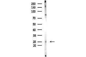 Western blot analysis of lysates from F10-LUC cells(LPS,4h treatment), using GS Antibody at 1/1000 dilution.