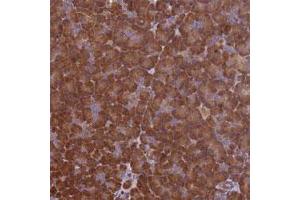 Immunohistochemical staining of human pancreas with VWA3A polyclonal antibody  shows strong cytoplasmic positivity in exocrine glandular cells at 1:1000-1:2500 dilution. (VWA3A antibody)