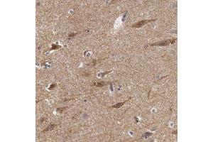 Immunohistochemical staining of human cerebral cortex with NLGN4X polyclonal antibody  shows moderate cytoplasmic positivity in neuronal cells at 1:50-1:200 dilution. (Neuroligin 4 antibody)