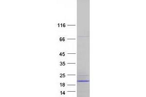 Validation with Western Blot (ATP5F1D Protein (Transcript Variant 2) (Myc-DYKDDDDK Tag))