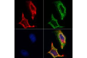 ABIN6262608 and ABIN6268730 staining Hela by IF/ICC. (ITGA3 antibody  (Internal Region))