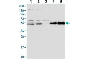 Western blot analysis of Lane 1: RT-4, Lane 2: U-251 MG, Lane 3: Human Plasma, Lane 4: Liver, Lane 5: Tonsil with PRRC1 polyclonal antibody .
