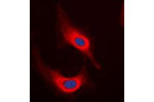 Immunofluorescent analysis of Desmin staining in HeLa cells.