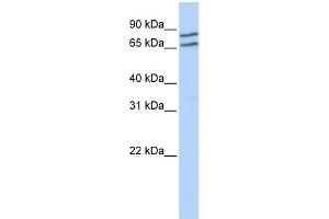 WB Suggested Anti-TFE3 Antibody Titration:  0. (TFE3 antibody  (Middle Region))