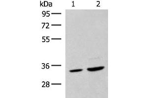 Western blot analysis of Hela cell and Human fetal liver tissue lysates using SCGN Polyclonal Antibody at dilution of 1:600 (SCGN antibody)
