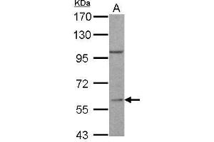 WB Image RGS14 antibody [C3], C-term detects RGS14 protein by Western blot analysis. (RGS14 antibody  (C-Term))