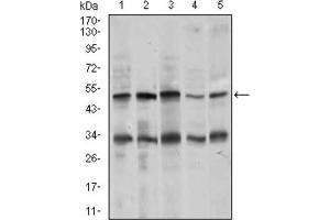 Western blot analysis using CHGA antibody against MOLT4 (1), SK-N-SH (2), HepG2 (3), PC-12 (4), and C6 (5) cell lysate. (Chromogranin A antibody  (AA 87-252))