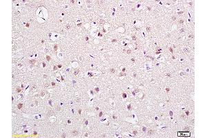 Lane 1: rat brain lysates Lane 2: rat kidney lysates probed with Anti PHLP Polyclonal Antibody, Unconjugated (ABIN715121) at 1:200 in 4 °C. (Phosducin-Like antibody  (AA 51-150))