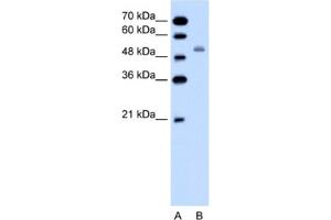 Western Blotting (WB) image for anti-Solute Carrier Family 12 (Sodium/potassium/chloride Transporters), Member 1 (SLC12A1) antibody (ABIN2462394) (SLC12A1 antibody)