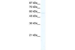 ACCN5 antibody used at 1. (ACCN5 antibody  (Middle Region))