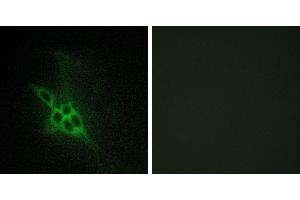 Peptide - +Immunohistochemistry analysis of paraffin-embedded human brain tissue using EPHB1/2/3 antibody. (EPH Receptor B1/2/3 (Internal Region) antibody)