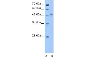 WB Suggested Anti-ZP4 Antibody Titration:  0. (ZP4 antibody  (N-Term))