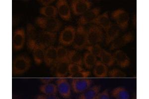 Immunofluorescence analysis of HeLa cells using RPL23A Polyclonal Antibody at dilution of 1:100. (RPL23A antibody)