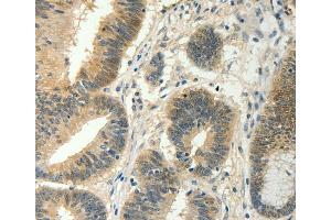 Immunohistochemistry (IHC) image for anti-Suppressor of Cytokine Signaling 5 (SOCS5) antibody (ABIN2428731) (SOCS5 antibody)