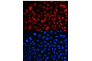 anti-Cyclin T1 (CCNT1) (AA 375-410), (Middle Region) antibody