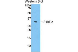 Western blot analysis of the recombinant protein. (IL17RD antibody  (AA 356-603))