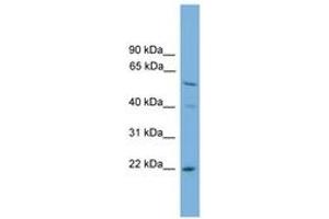 Image no. 1 for anti-Ubiquitin-Conjugating Enzyme E2T (Ube2t) (N-Term) antibody (ABIN6744736) (Ube2t antibody  (N-Term))