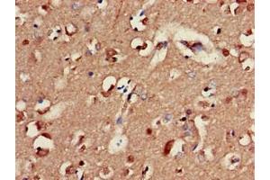 Immunohistochemistry of paraffin-embedded human brain tissue using ABIN7153479 at dilution of 1:100 (GABRA2 antibody  (AA 29-251))