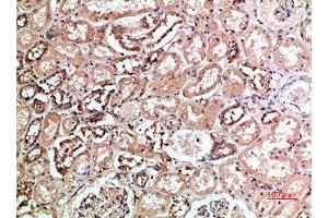 Immunohistochemical analysis of paraffin-embedded human-kidney, antibody was diluted at 1:200 (KIR2DL5A antibody  (AA 121-170))