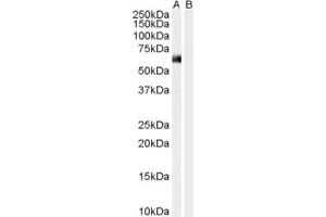 Western Blotting (WB) image for anti-Syntrophin, alpha 1 (Dystrophin-Associated Protein A1, 59kDa, Acidic Component) (SNTA1) (N-Term) antibody (ABIN2465307) (SNTA1 antibody  (N-Term))