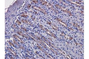 Immunohistochemistry (IHC) image for anti-EGFR (Cetuximab Biosimilar) antibody (ABIN5668058)