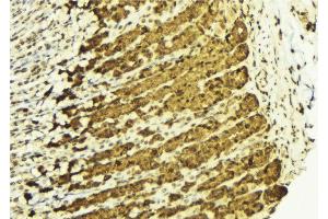 ABIN6269050 at 1/100 staining Human gastric tissue by IHC-P. (IKK alpha antibody  (N-Term))