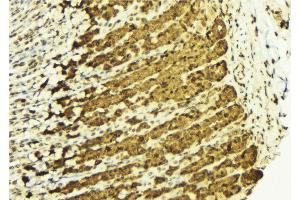ABIN6269050 at 1/100 staining Human gastric tissue by IHC-P.
