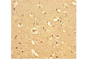 Immunohistochemistry of paraffin-embedded human brain tissue using ABIN7159225 at dilution of 1:100 (MRAP2 antibody  (AA 66-205))