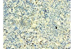 Immunohistochemistry of paraffin-embedded human thyroid tissue using ABIN7171313 at dilution of 1:100 (T-Box 22 antibody  (AA 291-520))