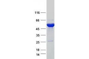 Western Blotting (WB) image for Alanine-Glyoxylate Aminotransferase 2-Like 1 (AGXT2L1) protein (Myc-DYKDDDDK Tag) (ABIN2714471)