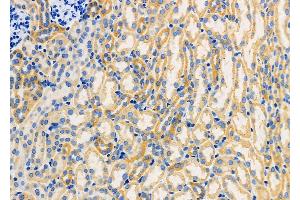 ABIN6259791 and ABIN6266850 at 1/100 staining Mouse kidney tissue by IHC-P. (ADCK1 antibody  (Internal Region))