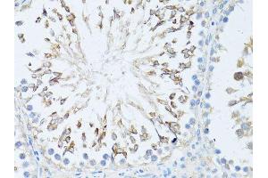 Immunohistochemistry (Paraffin-embedded Sections) (IHC (p)) image for anti-Transcription Elongation Factor, Mitochondrial (TEFM) (AA 36-210) antibody (ABIN6148990)