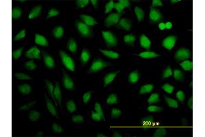 Immunofluorescence of monoclonal antibody to THRAP5 on HeLa cell. (MED16 antibody  (AA 1-110))