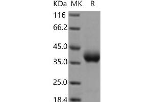 Western Blotting (WB) image for Prolactin Receptor (PRLR) protein (His tag) (ABIN7321228) (Prolactin Receptor Protein (PRLR) (His tag))