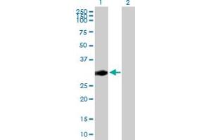 Western Blot analysis of CENPP expression in transfected 293T cell line by CENPP MaxPab polyclonal antibody. (CENPP antibody  (AA 1-288))