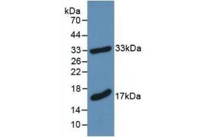 Detection of Recombinant MBP, Mouse using Polyclonal Antibody to Myelin Basic Protein (MBP) (MBP antibody  (AA 18-222))