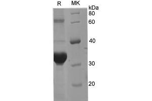 Western Blotting (WB) image for Interferon alpha/beta Receptor 1 (IFNAR1) protein (His tag) (ABIN7320874) (IFNAR1 Protein (His tag))