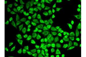 Immunofluorescence analysis of HeLa cell using IL7R antibody. (IL7R antibody  (AA 21-239))