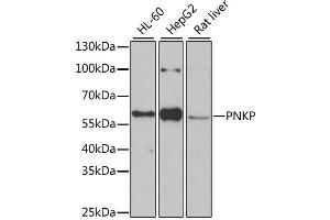 Western blot analysis of extracts of various cell lines, using PNKP antibody (ABIN2564598) at 1:1000 dilution. (PNKP antibody)