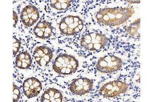 Immunohistochemistry analysis of paraffin-embedded human colon using Claudin 5 Polyclonal Antibody at dilution of 1:400. (Claudin 5 antibody)