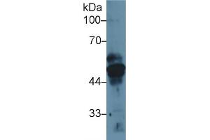 Western Blot; Sample: Human MCF7 cell lysate; Primary Ab: 1µg/ml Rabbit Anti-Rat KRT17 Antibody Second Ab: 0. (KRT17 antibody  (AA 84-392))