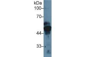 Western Blot; Sample: Human MCF7 cell lysate; Primary Ab: 1µg/ml Rabbit Anti-Rat KRT17 Antibody Second Ab: 0.