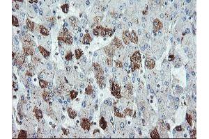 Immunohistochemical staining of paraffin-embedded Human liver tissue using anti-SDCBP mouse monoclonal antibody. (SDCBP antibody)