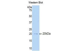 Western Blotting (WB) image for anti-Interleukin 3 Receptor, alpha (IL3RA) (AA 17-166) antibody (ABIN3206515) (IL3RA antibody  (AA 17-166))