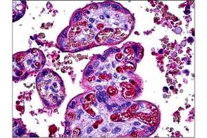 Human Placenta: Formalin-Fixed, Paraffin-Embedded (FFPE). (C3 antibody)