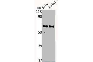Western Blot analysis of HELA Jurkat cells using CYP4F2 Polyclonal Antibody (CYP4F2 antibody  (N-Term))