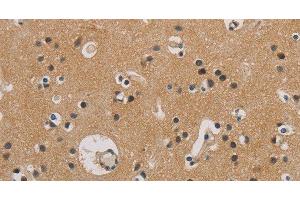 Immunohistochemistry of paraffin-embedded Human brain tissue using ITGB3BP Polyclonal Antibody at dilution 1:50 (ITGB3BP antibody)