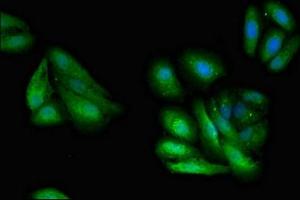 Immunofluorescent analysis of HepG2 cells using ABIN7154688 at dilution of 1:100 and Alexa Fluor 488-congugated AffiniPure Goat Anti-Rabbit IgG(H+L) (GNB1 antibody  (AA 157-248))